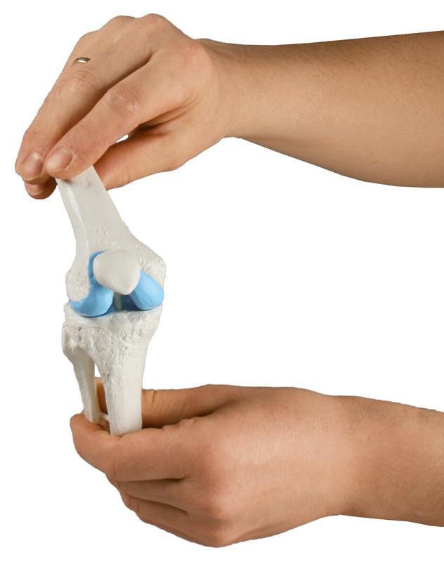 Knie-Implantat-Modell, 1125 - Notemed Medizintechnik