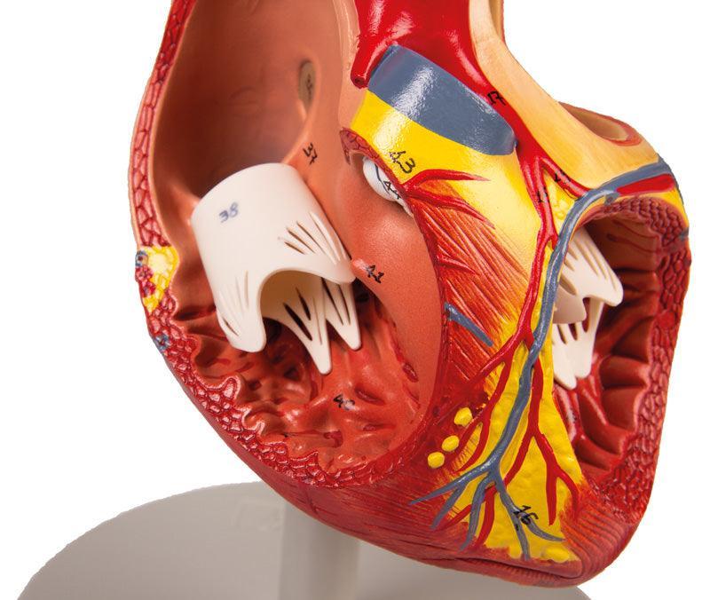 Herzmodell, 2-fache Lebensgröße, 4 Teile, G112 - Notemed Medizintechnik
