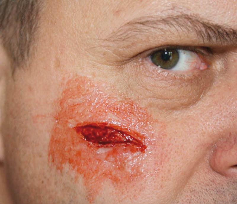 EZ Wounds Wundensimulationsset „Professional“, WS02 - Notemed Medizintechnik