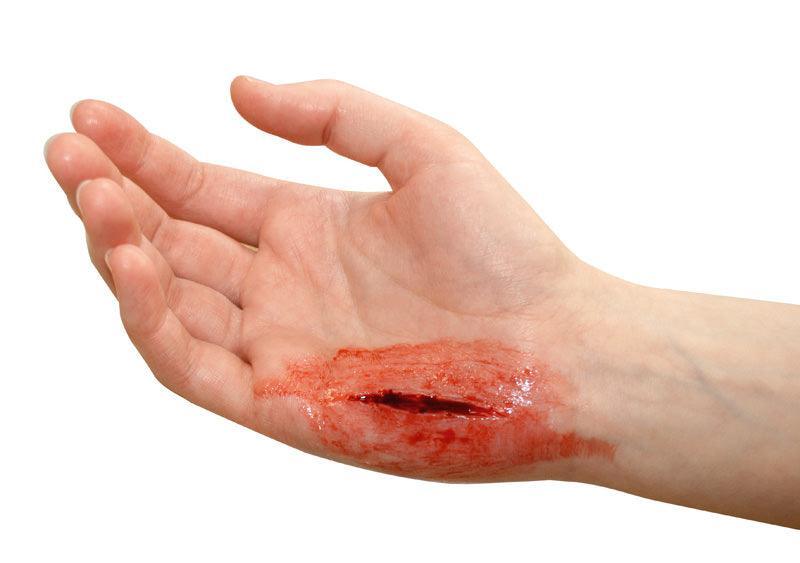 EZ Wounds Wundensimulationsset „Professional“, WS02 - Notemed Medizintechnik