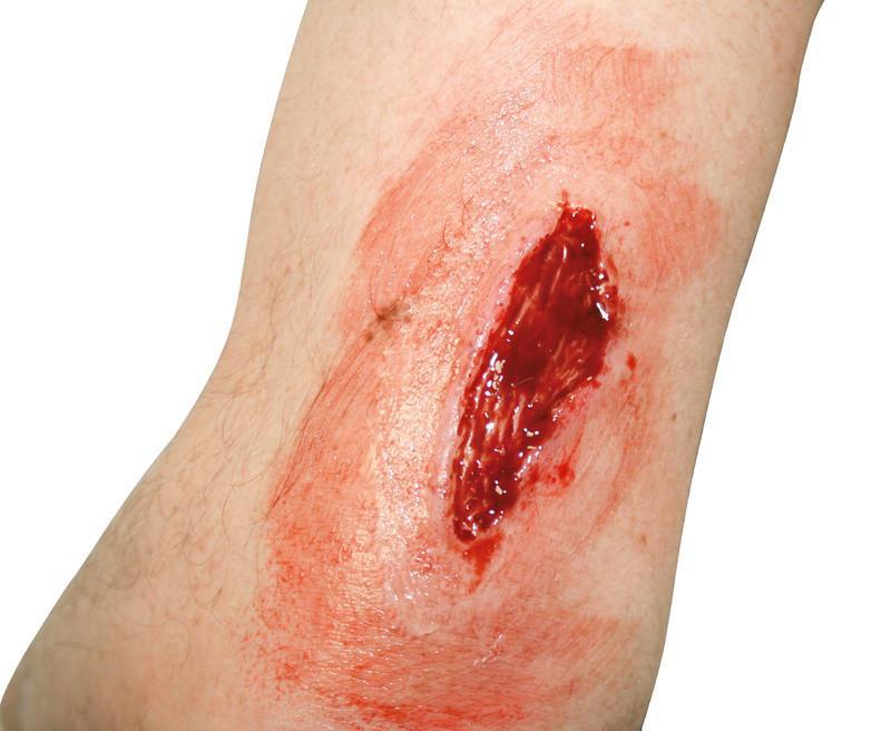EZ Wounds Wundensimulationsset „Professional“, WS02 - Notemed Medizintechnik