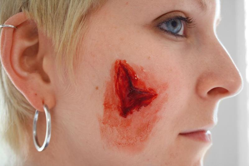 EZ Wounds Wundensimulationsset „Professional“, WS02 - Notemed Medizintechnik
