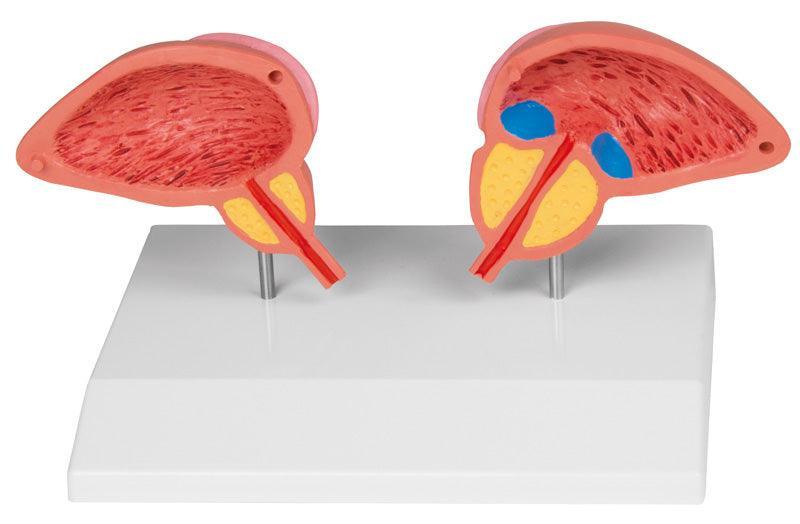 Prostata Modell, 2-teilig, 1261 - Notemed Medizintechnik 