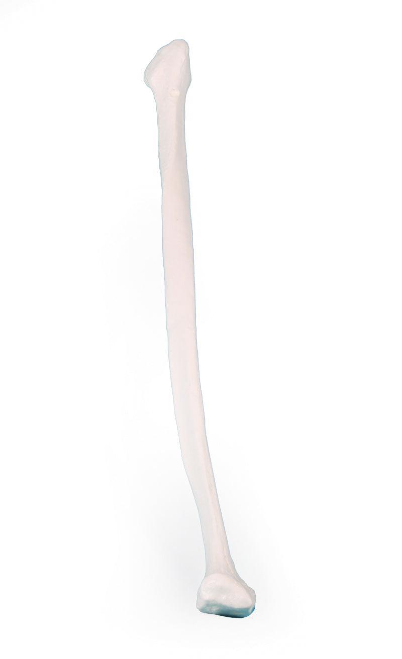 Fibula (Wadenbein), 3052 - Notemed Medizintechnik 