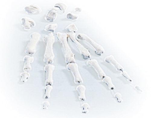 Handknochen, unmontiert, 3080 - Notemed Medizintechnik 