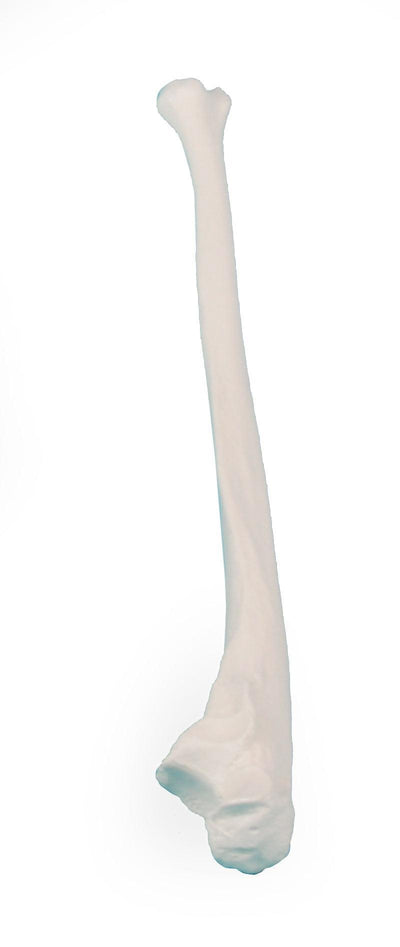 Ulna (Elle), 3081 Erler-Zimmer