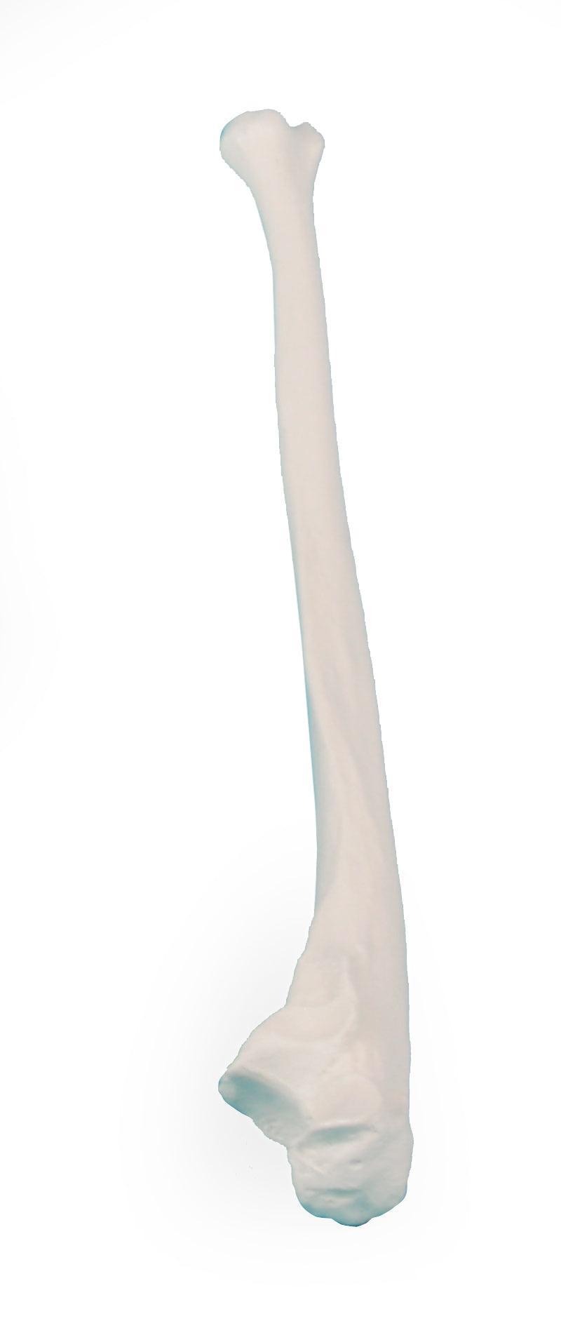 Ulna (Elle), 3081 - Notemed Medizintechnik 