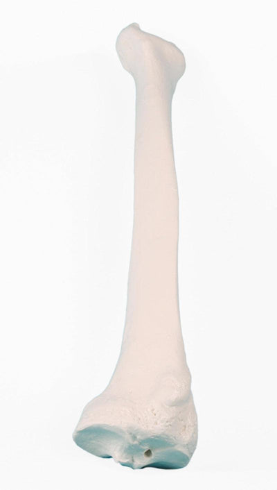 Radius (Speiche), 3082 - Notemed Medizintechnik 