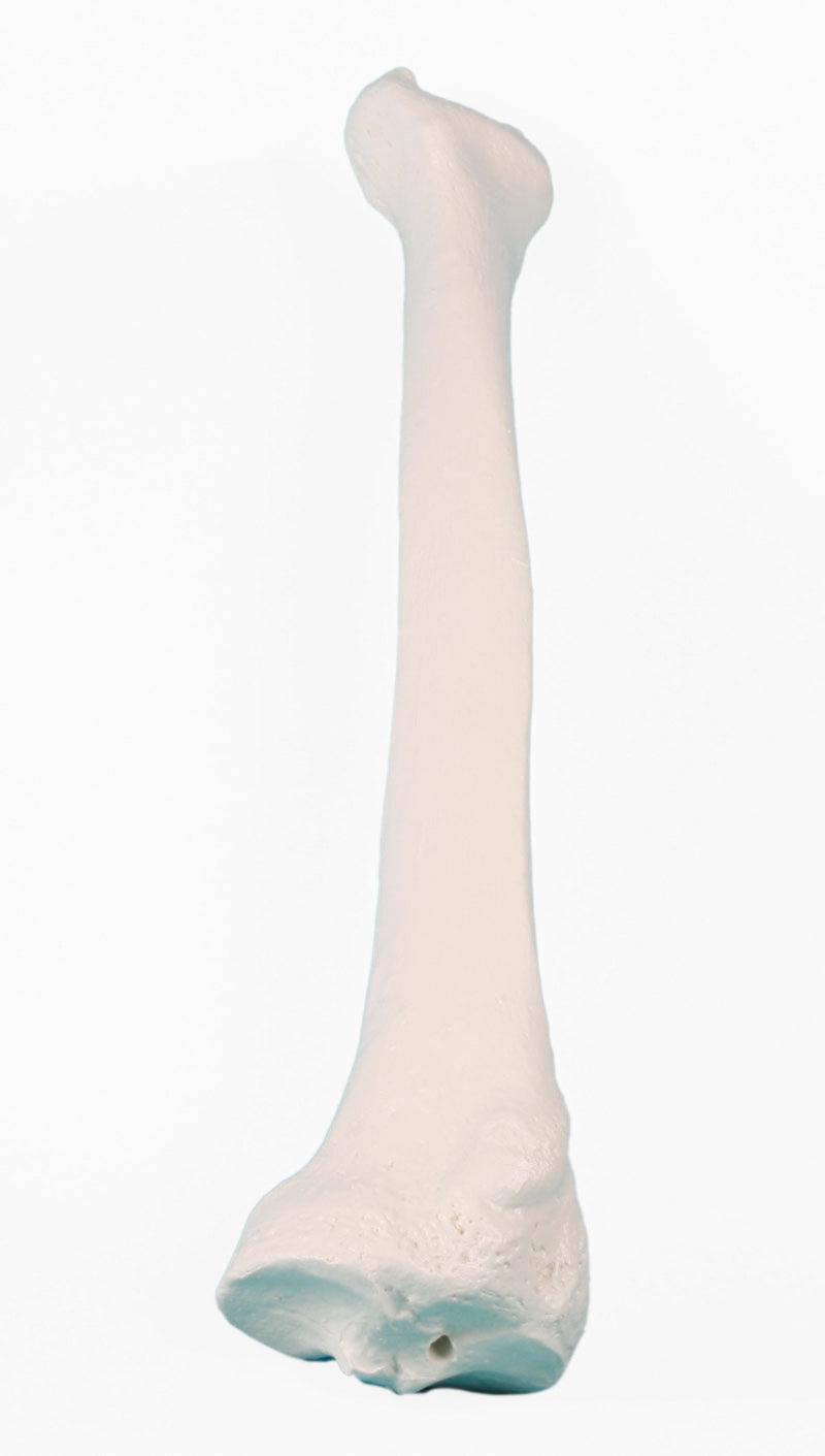 Radius (Speiche), 3082 - Notemed Medizintechnik 