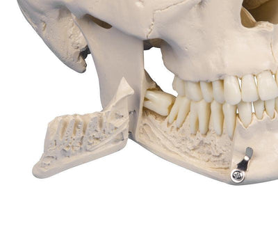 Dental-Schädel, 4-teilig, 4513 Erler-Zimmer