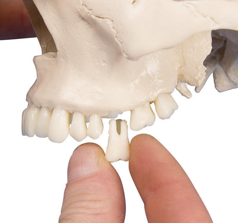 Dental-Schädel, 4-teilig, 4513 - Notemed Medizintechnik 