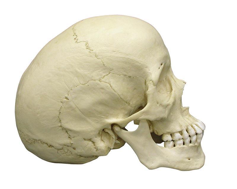 Skaphozephaler Schädel, 4778 - Notemed Medizintechnik 