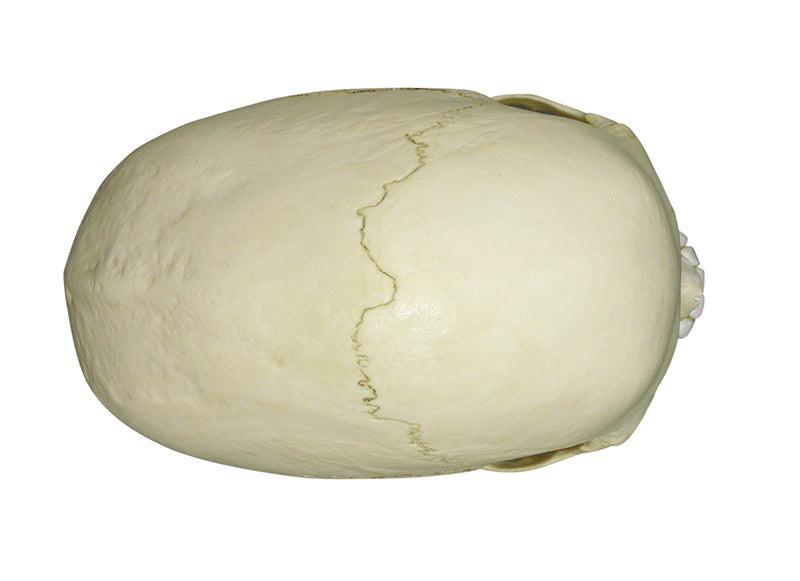 Skaphozephaler Schädel, 4778 - Notemed Medizintechnik 