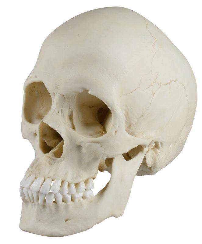 Skaphozephaler Schädel, 4778 - Notemed Medizintechnik 