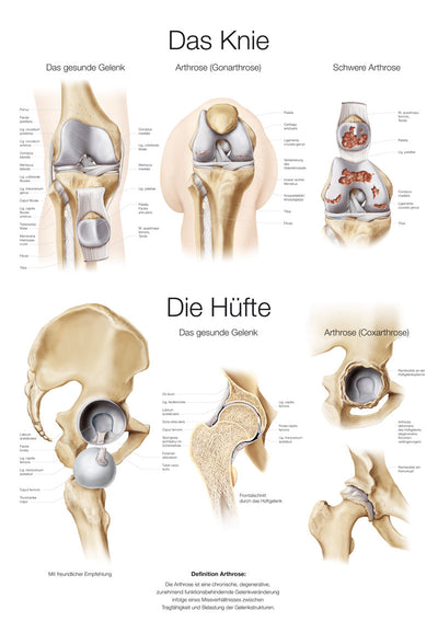 Lehrtafel "Das Knie / Die Hüfte" (deutsch), 70x100cm, AL151 Erler-Zimmer