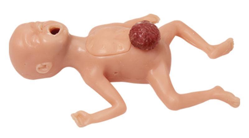 Übungsbaby für die Pflegeausbildung, männlich, BA85 - Notemed Medizintechnik 