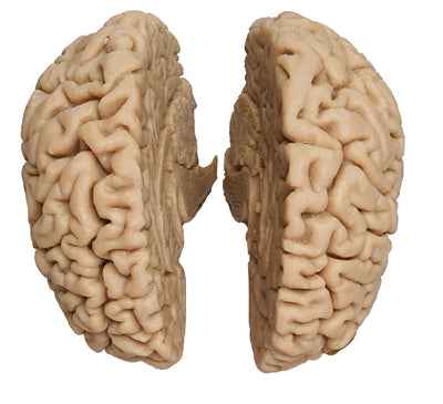 Menschliches Gehirn, Naturabguss, C710 Erler-Zimmer