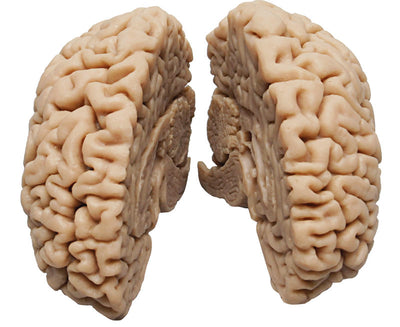 Menschliches Gehirn, Naturabguss, C715 Erler-Zimmer