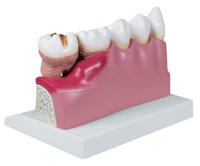 Dentalmodell, 4-fache Größe - EZ Augmented Anatomy, D250 Erler-Zimmer