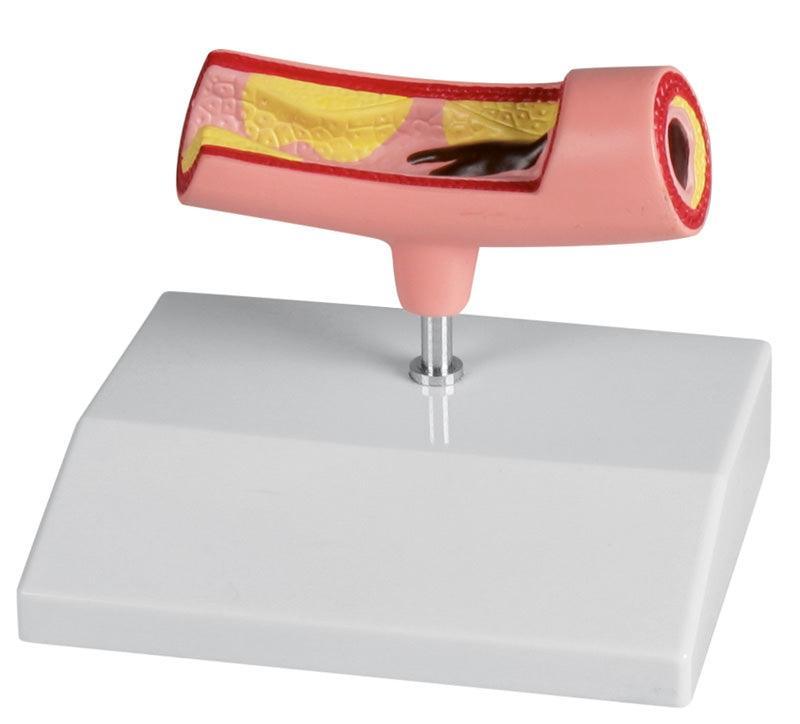 Arterienmodell, G241 - Notemed Medizintechnik 