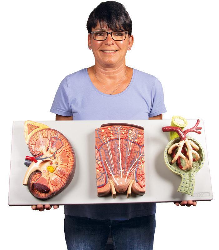 Nierenschnitt, Nephron und Nierenkörperchen, K111 - Notemed Medizintechnik 