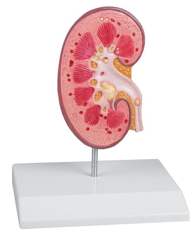 Nierensteinmodell - EZ Augmented Anatomy, K229 - Notemed Medizintechnik 