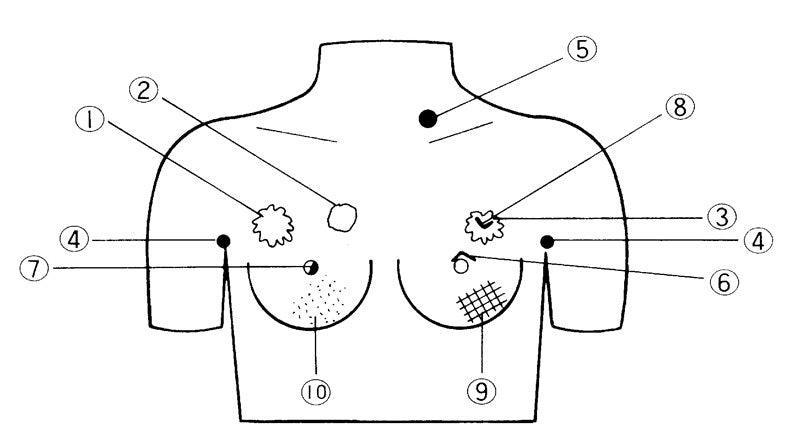 Brustkrebs-Tastmodell, LM18 - Notemed Medizintechnik 