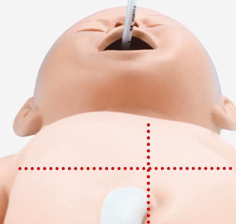 Intubations- und Wiederbelebungs-Neugeborenes, LM89 - Notemed Medizintechnik 
