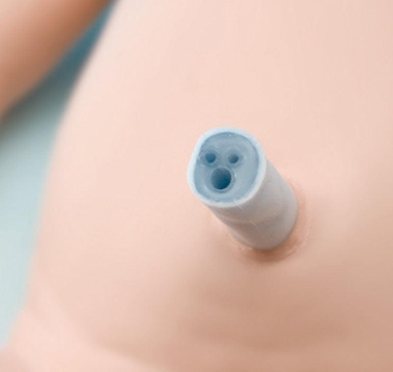 Intubations- und Wiederbelebungs-Neugeborenes, LM89 - Notemed Medizintechnik 