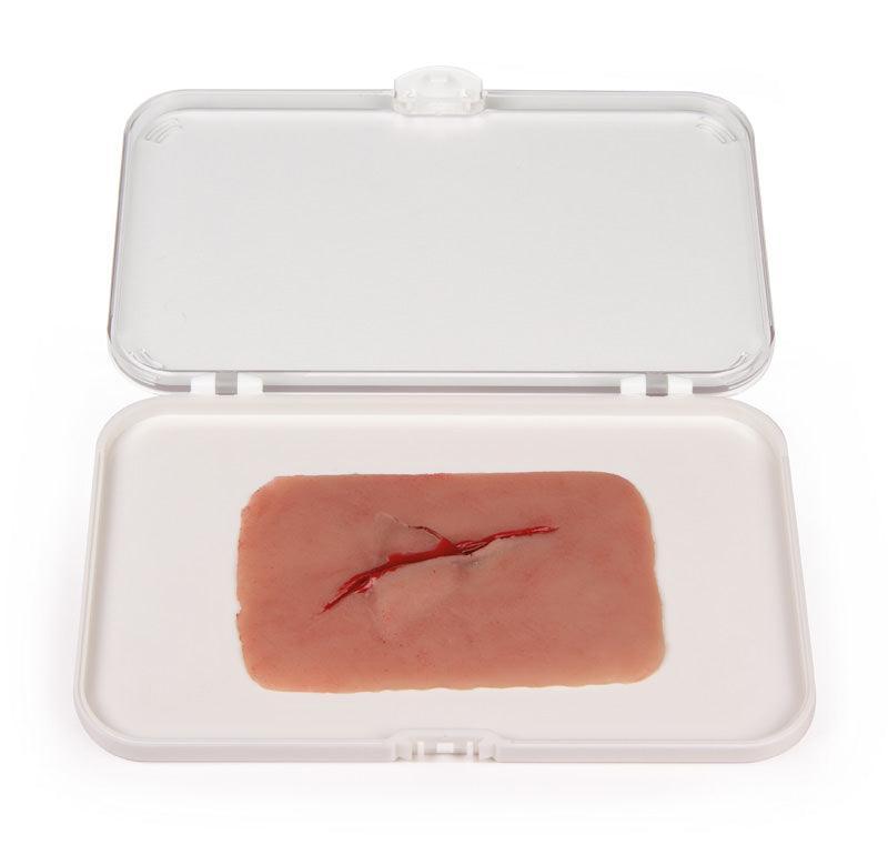 Wundmoulage Schnittwunde mit Glassplitter, NW001 - Notemed Medizintechnik 