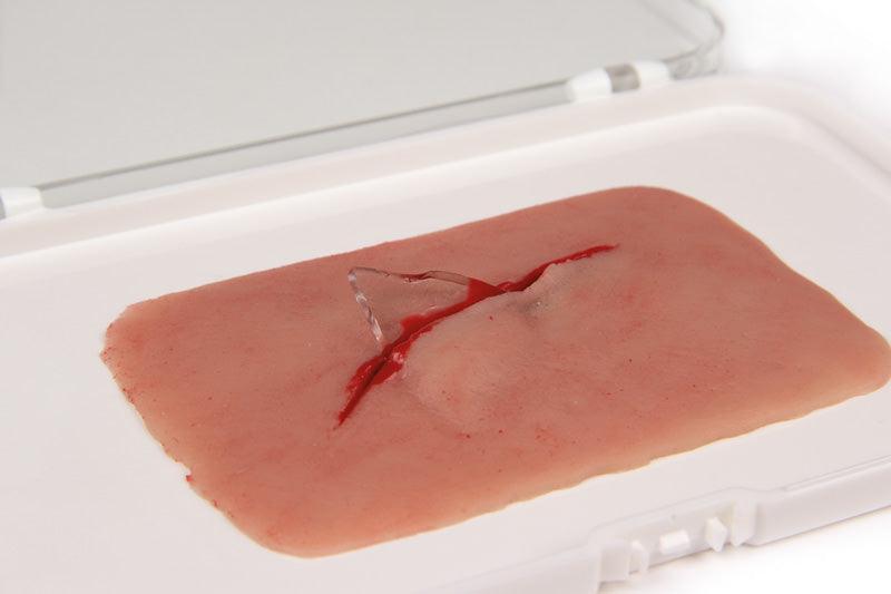Wundmoulage Schnittwunde mit Glassplitter, NW001 - Notemed Medizintechnik 