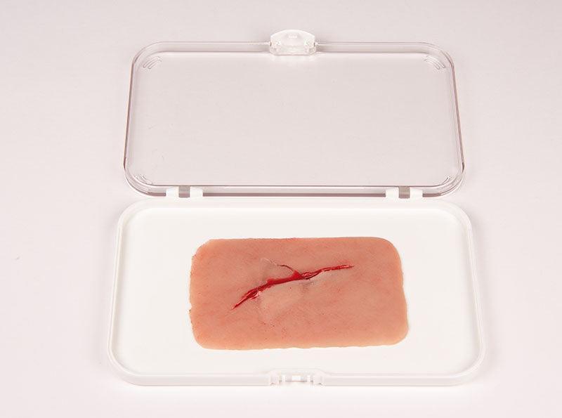 Wundmoulage Schnittwunde mit Glassplitter, NW001 - Notemed Medizintechnik 