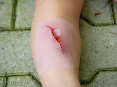 Wundmoulage Schnittwunde mit Glassplitter, NW001 - Notemed Medizintechnik 