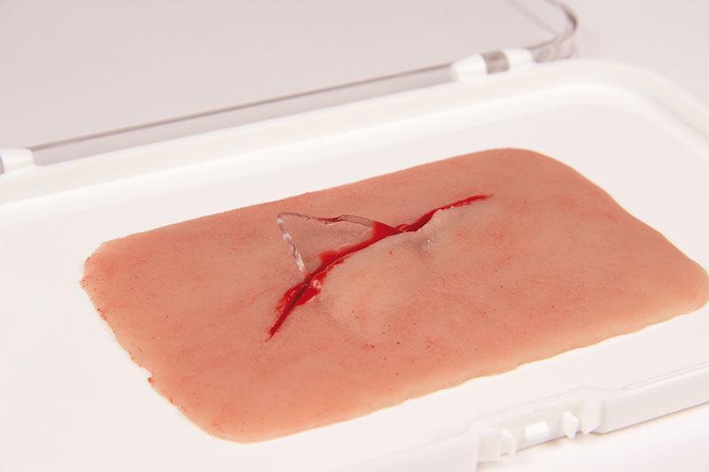 Wundmoulage Schnittwunde mit Glassplitter, NW001 - Notemed Medizintechnik 