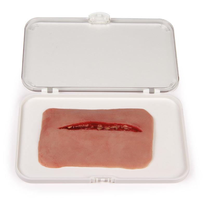 Wundmoulage Schnittwunde, NW002 - Notemed Medizintechnik 