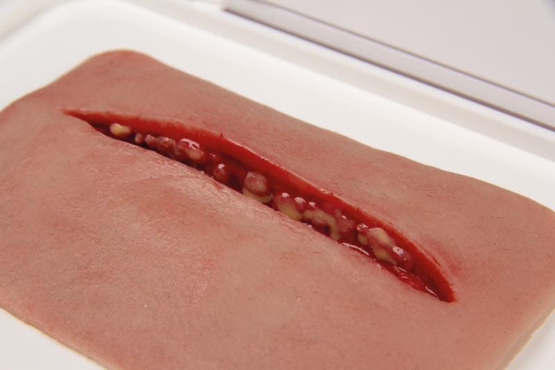 Wundmoulage Schnittwunde, NW002 - Notemed Medizintechnik 