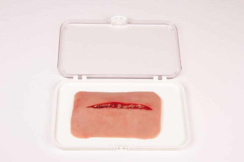 Wundmoulage Schnittwunde, NW002 - Notemed Medizintechnik 