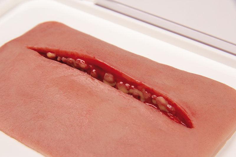 Wundmoulage Schnittwunde, NW002 - Notemed Medizintechnik 