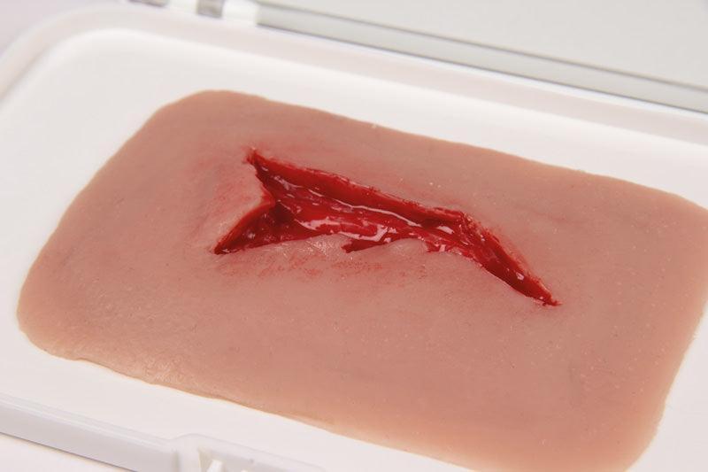 Wundmoulage Risswunde, NW003 - Notemed Medizintechnik 