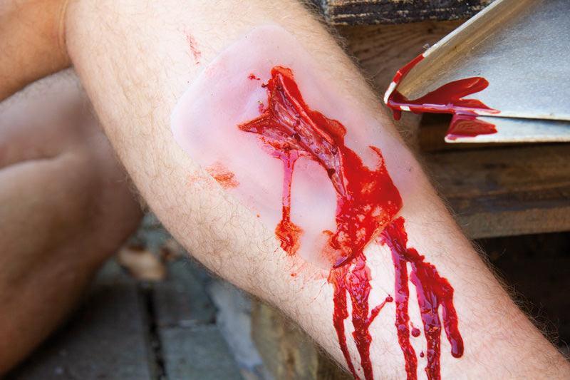 Wundmoulage Risswunde, NW003 - Notemed Medizintechnik 