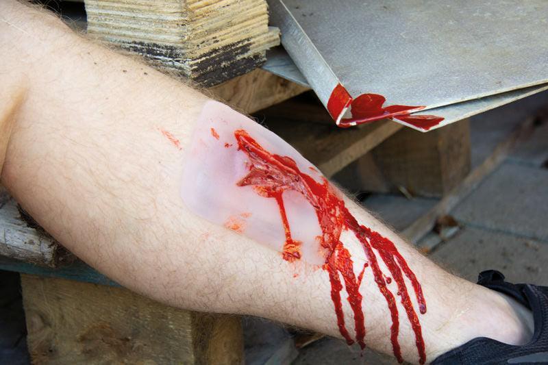 Wundmoulage Risswunde, NW003 - Notemed Medizintechnik 