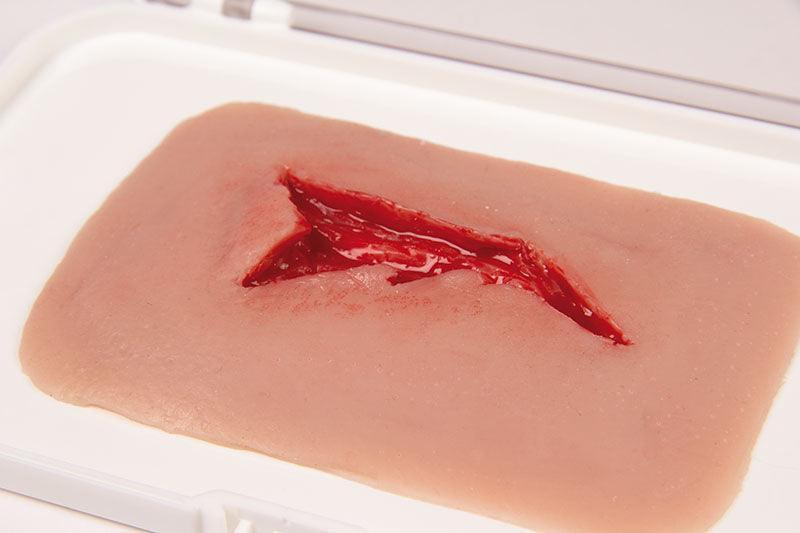 Wundmoulage Risswunde, NW003 - Notemed Medizintechnik 