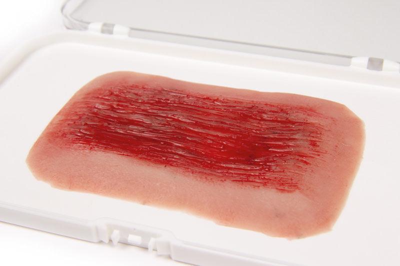 Wundmoulage Schürfwunde, NW006 - Notemed Medizintechnik 