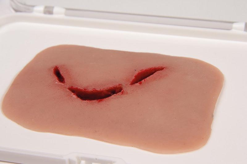 Wundmoulage Schnittwunde Flasche, NW009 - Notemed Medizintechnik 