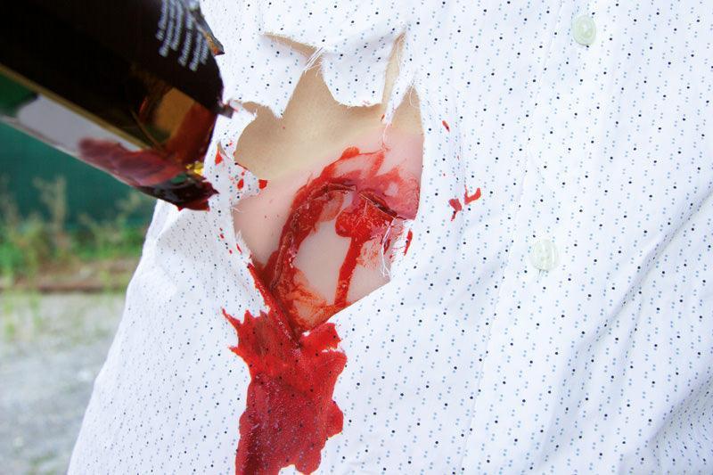 Wundmoulage Schnittwunde Flasche, NW009 - Notemed Medizintechnik 