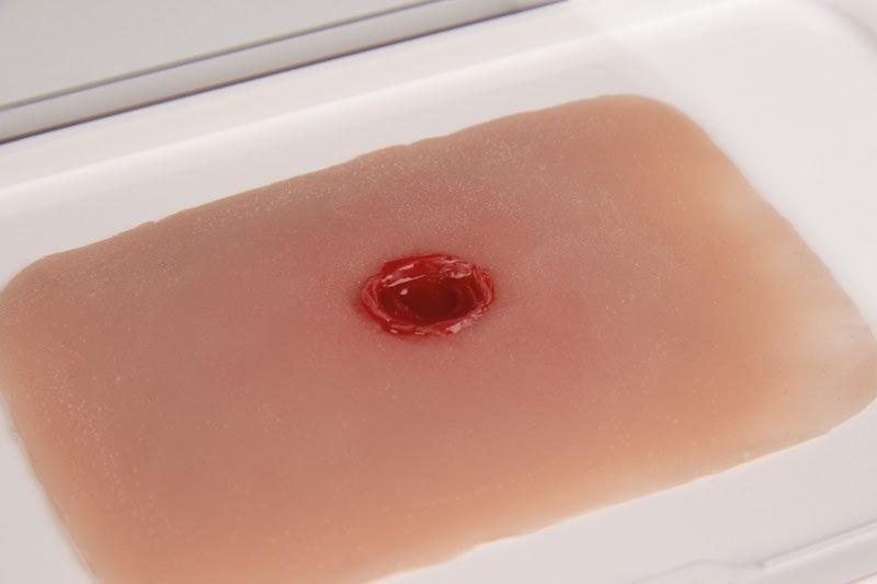Wundmoulage Einschußwunde, NW010A - Notemed Medizintechnik 