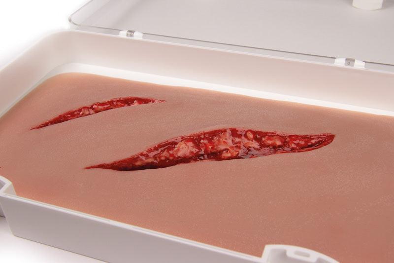 Schnittwunde groß mit Blutungsfunktion, NW100 - Notemed Medizintechnik 