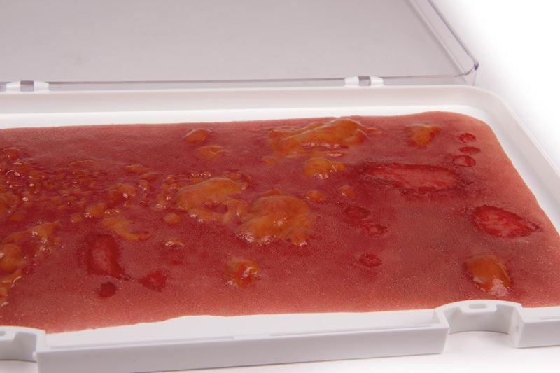 Wundmoulage Verbrennung II. Grades, NW106 - Notemed Medizintechnik 