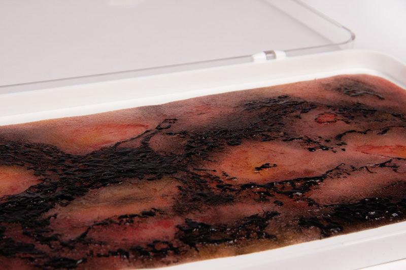 Wundmoulage Verbrennung III. Grades, NW107 - Notemed Medizintechnik 