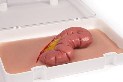 Wundmoulage Dickdarmaustritt, NW109 - Notemed Medizintechnik 